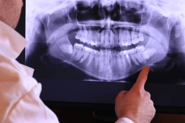 Best Emergency Dental Care for Sports Injuries in New Madison, OH
