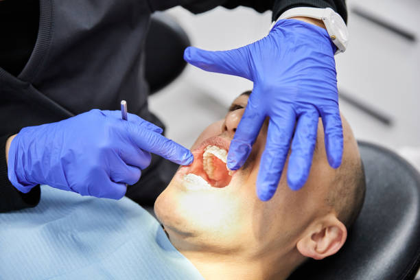 Best Emergency Wisdom Tooth Extraction in New Madison, OH